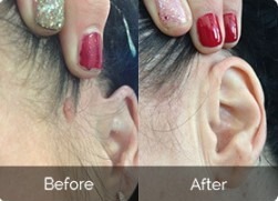 Best Mole and Skin Tag Serum Repair Prices